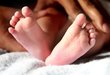 Najczęstsze wady stóp u dzieci i dorosłych